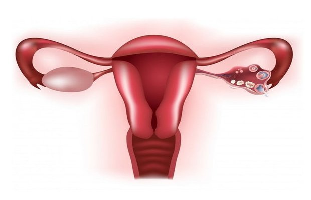 endometriozis-cikolata-kisti-nedir-neden-olur-nasil-tedavi-edilir-Iphc8X77.jpg